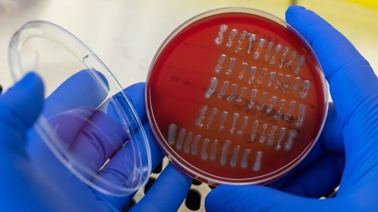Las bacterias transmitidas por los alimentos podrían estar causando más de medio millón de infecciones urinarias en los EE. UU. cada año, según un estudio