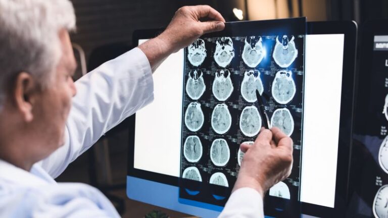 Los funcionarios de salud de EE. UU. tienen como objetivo ‘transformar’ la investigación de la enfermedad de Alzheimer con una plataforma de datos de $ 300 millones