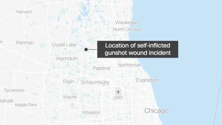 Un hombre de Illinois disparó su arma después de soñar que un ladrón estaba en su casa, dice la policía.  Se disparó en la pierna en la vida real.