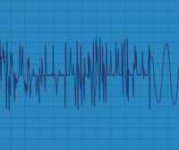 Sismo de magnitud 6,5 sacude a Colombia – Remolacha