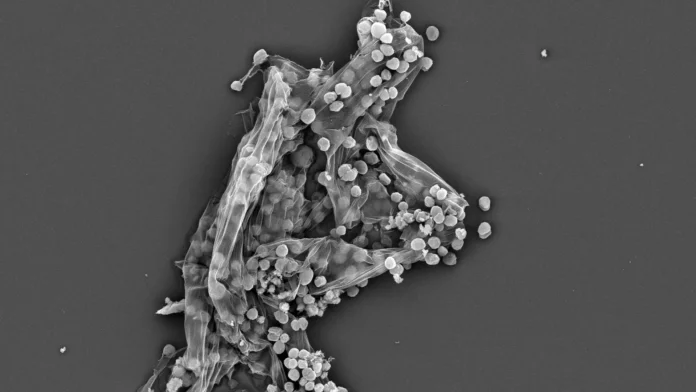 electron-microscope-image-methanogens.webp.webp