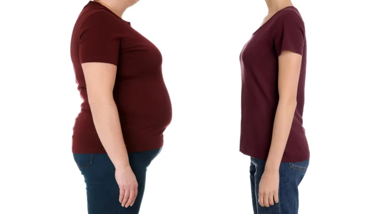 La cirugía supera a Ozempic en salud a largo plazo, según la Clínica Cleveland