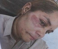 Raso golpea brutalmente a mujer frente a su hijo – Remolacha