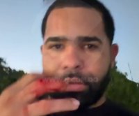 “Miren cómo me dejó Mantequilla” (video) – Remolacha