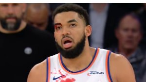 Karl-Anthony Towns termina con una tremenda cortadura sobre el ojo derecho – Remolacha