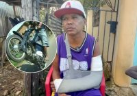 “Me rompió el brazo y siguió como si nada” – Remolacha